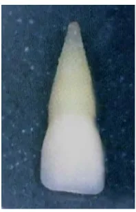 Fig. 8 Amplitud del 
