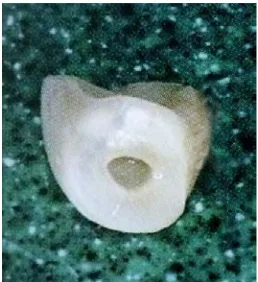 Fig. 10 Ajuste del póntico.