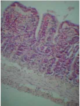 Figura 10. Grado 2 