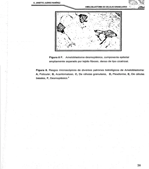 Figura 8. Rasgos microscópicos de diversos patrones histológicos de Ameloblastoma: 