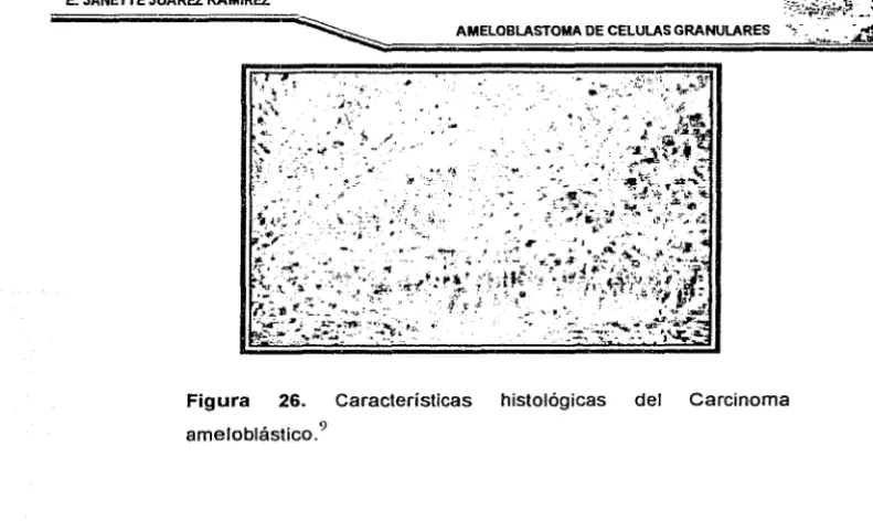 Figura 27. Características histológicas del Oncocitoma. 9 