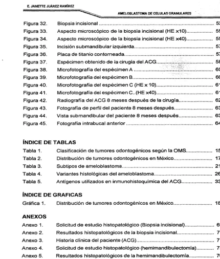 Figura 32. 