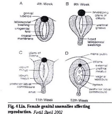 Fig. 4 Lln. F emale genital anomalie1 affecting reproductioJL fotil 2002 