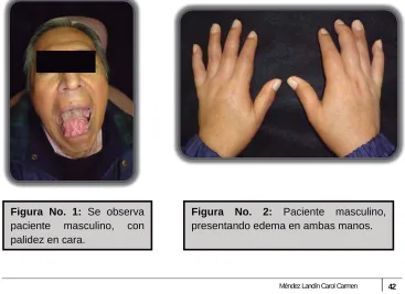 Figura No. 1: Se observa paciente masculino, con 