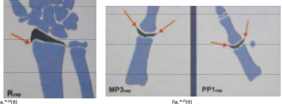 Fig.*14(8)                                                                                                                         fig.*15(9) 