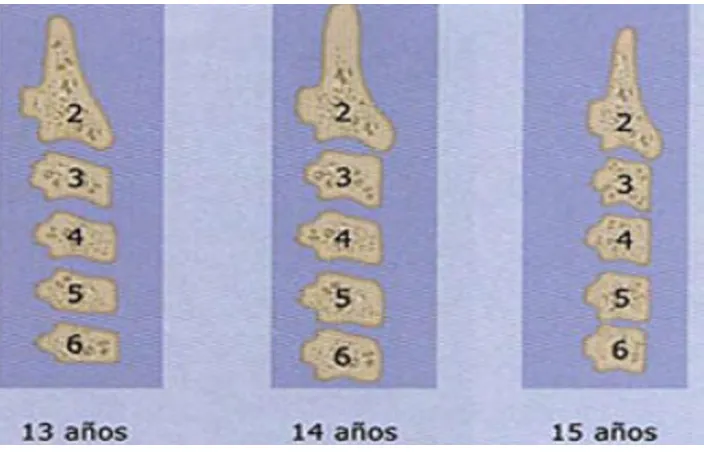 Fig. *29(22) .Proceso de maduración de las vértebras cervicales por edad en niñas 