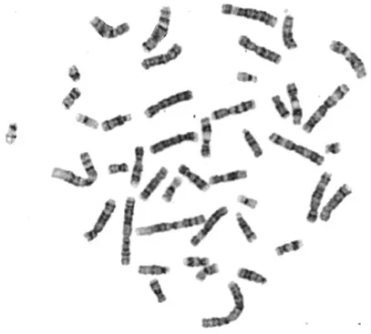 Figura Laboratoriocromosoma.3. Cariotipo en metafase con bandas GTG, de una paciente femenina normal, con fórmula  cromosómica  46,XX.  Se  observa  el  patrón  de  bandas  claras  y  oscuras  en  cada   (Imagen  realizada  por  la  Biol.  Ariadna  Berenice  Morales  Jiménez  del  de Citogenética del Depto. de Genética del HIMFG) 