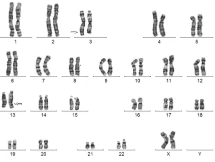 Figura  13.  Cariotipo  con  bandas  GTG  de  la  madre.  Están  señalados  los  cromosomas involucrados en la traslocación y el punto de ruptura. 
