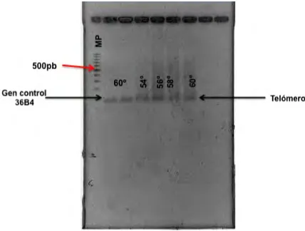 Fig. 13 Imagen de un gel de agarosa al 2% en el cual se observan los fragmentos correspondientes a la secuencia de telómero y la secuencia del gen control 36B4 de aproximadamente 100pb para ambos; como lo indica el marcador de peso molecular en el primer p