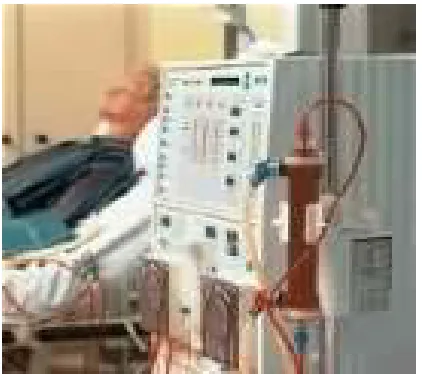 Fig. 3.2  Paciente conectado a un equipo de hemodiálisis 