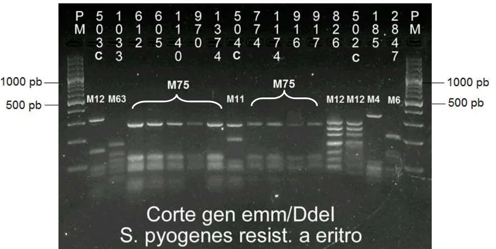 Figura 8. Gel de agarosa al 2.5% donde se muestran algunos RFLP´s del gen emm. Se 