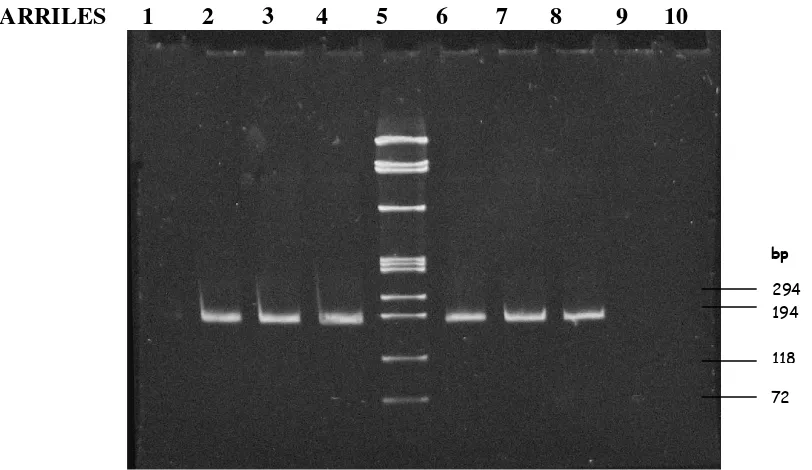 Figura 6.- Productos de amplificación del marcador genético Hae III 663, en un gel de poliacrilamida al 12% teñido con bromuro de etidio