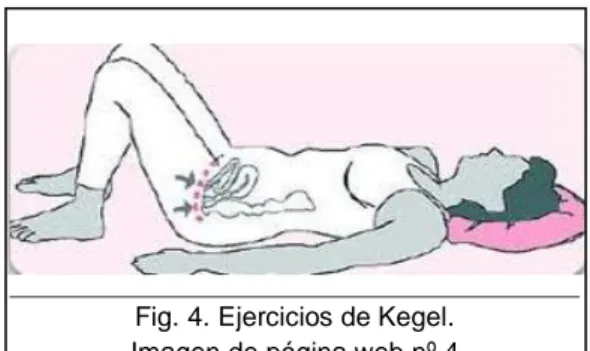 Fig. 4. Ejercicios de Kegel.                                   