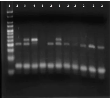 Fig. 8. Geles de agarosa al 3% mostrando los  genotipos de la mutación Ile1,016 en Ae