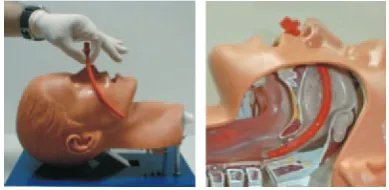 Figura 2. Cánula orofaríngea