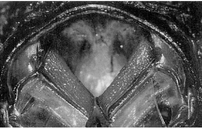 Fig.- Sección de la cicada en el que se ve la cavidad abdominal, los dos músculos timpánicos en V