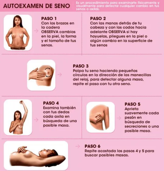 Fig. 2 Autoexamen de seno (Tomado de: [30]) 
