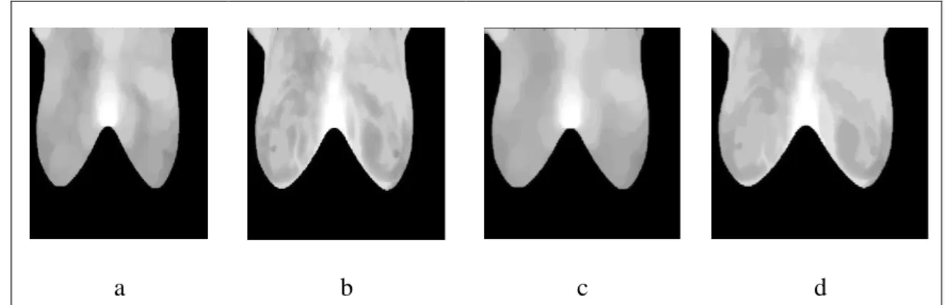 Fig. 29 Operadores Morfológicos  