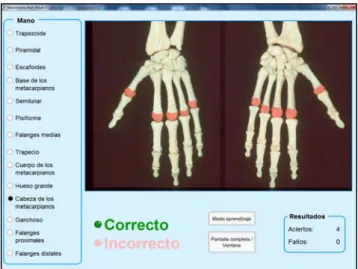 FIGURA 1.- Ejemplo de uno de los ítems  de módulo de  autoaprendizaje y autoevaluación práctico elaborado con  Macromedia Flash Player