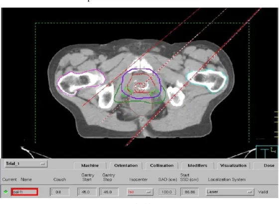 Fig. 20  Orientiación del haz 