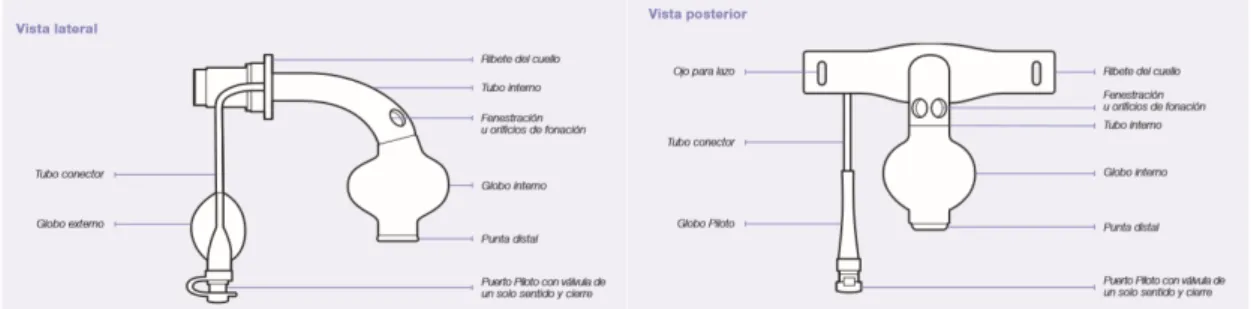 Ilustración 2: Vista lateral cánula de  traqueostomía  (18)