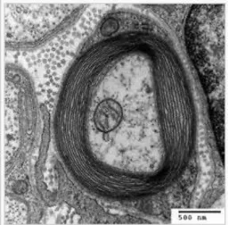 Figura 1. 8 El muñón distal.  