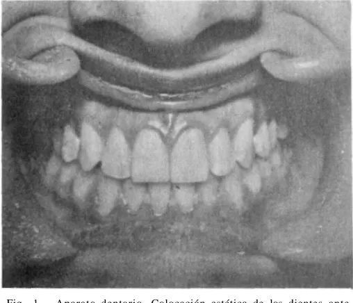 Fig. 1. 