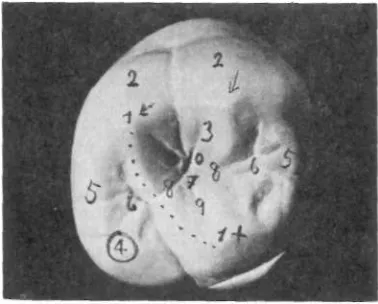Fig. 20. Enumeración de los distintos elementos de la cara oclusal de un diente (primer molar superior).vértice de la cúspide.mada