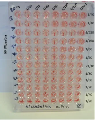 Figura 28. Lectura del ensayo de RIH con hematíes de gallina al 0,75% en placa de fondo “V”