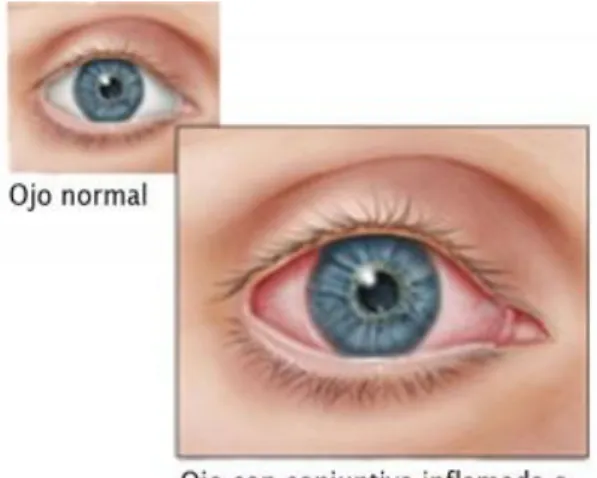 Figura 3. Ilustración de la anatomía completa del ojo  