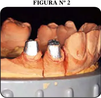 FIGURA Nº 4