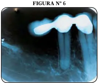 FIGURA Nº 5