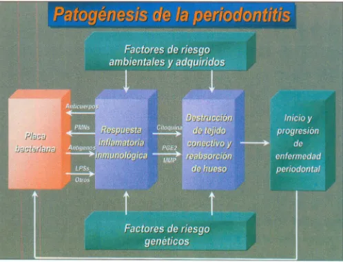 Fig. lO. Patogénesis de la periodontitis.