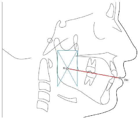 Figura 11: Plano A. 