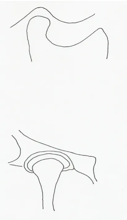 Figura 2: Fosa glenoide o articular (vista lateral y de frente).