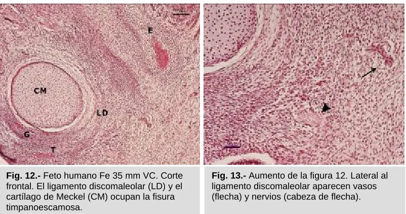 Fig. 12.- Feto humano Fe 35 mm VC. Corte frontal. El ligamento discomaleolar (LD) y el 