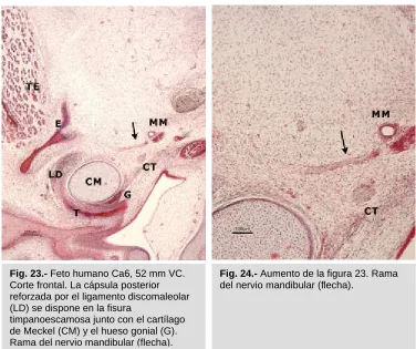 Fig. 23.- Feto humano Ca6, 52 mm VC. Corte frontal. La cápsula posterior 