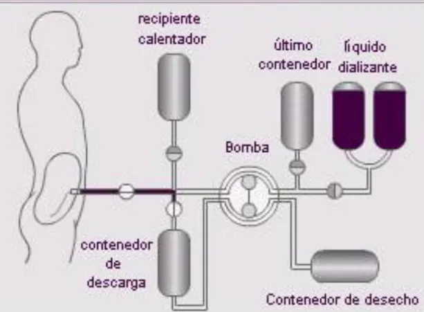 Fig. 4  Diagrama de diálisis peritoneal continua ambulatoria 