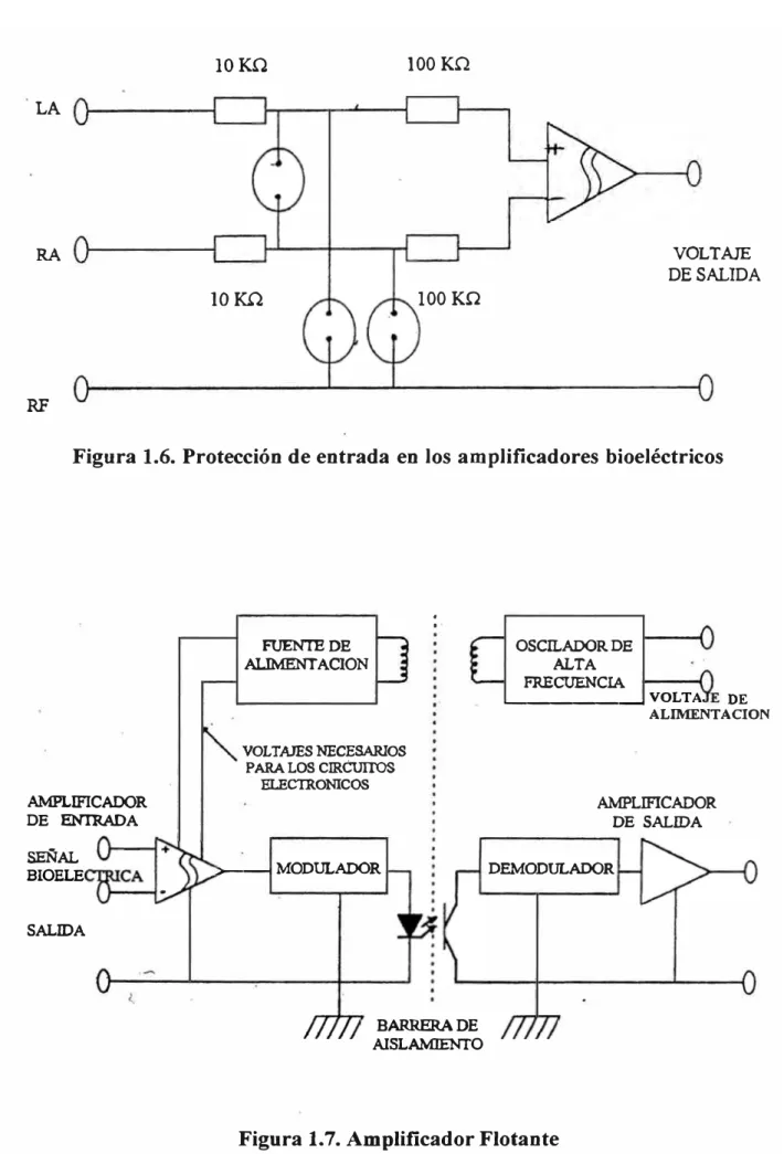 Figura 1.6. Protección de entrada en los amplificadores bioeléctricos 