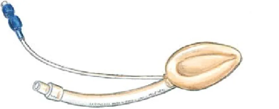 Figura 7. Mascarilla laríngea.