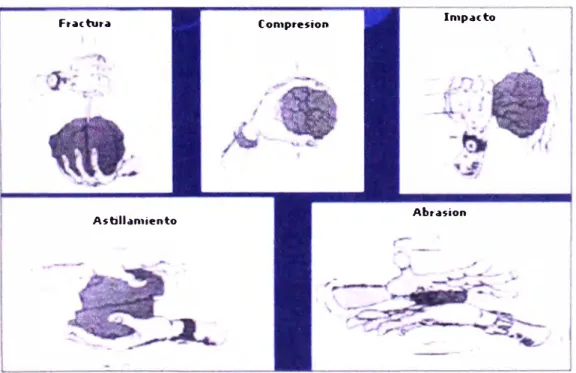 Fig. 2.13: Métodos de Fractura. 