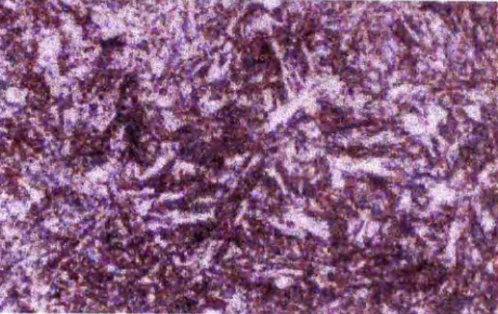 Figura  6.6- Vista microscópica del acero de herramienta S7 después  del tratamiento criogénico 