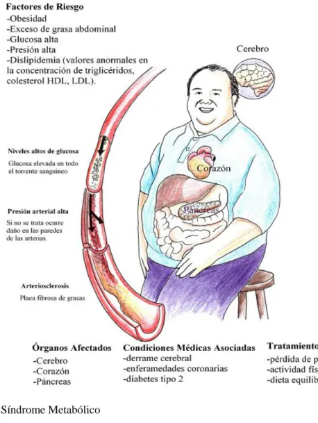 Gráfico 4: Síndrome Metabólico 