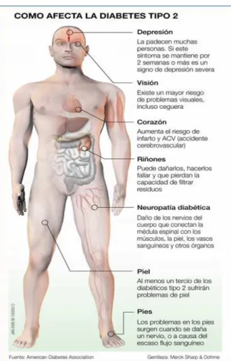 Gráfico 5: Complicaciones 