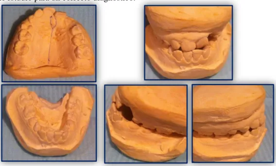 Figura 10. Modelos de estudio (a) Superior (b) Inferior (c) Frontal (d) Derecha (e) Izquierda