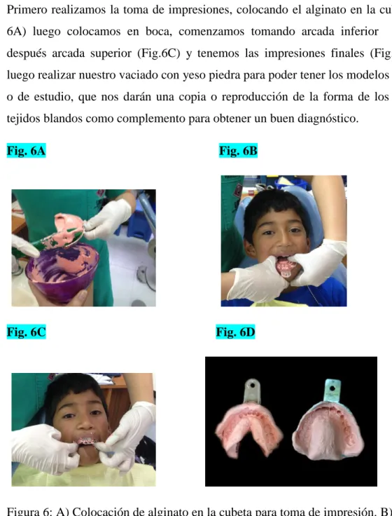 Fig. 6A                                                       Fig. 6B 