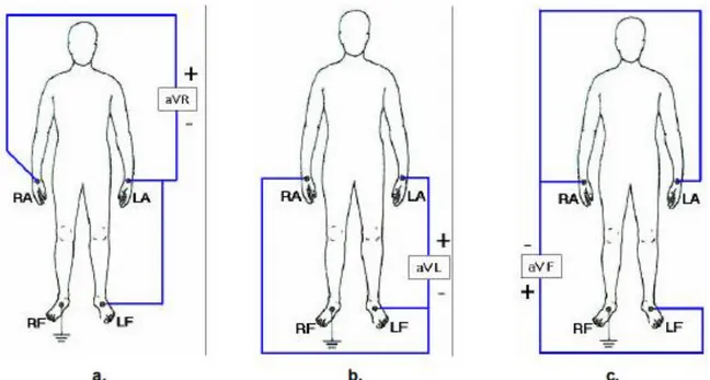 Figura  3. Derivaciones Unipolares en el plano frontal. La figura (a) corresponde a la derivación aVR, la figura  (b) corresponde a la derivación aVL y la figura (c) corresponde a la derivación aVF [22]