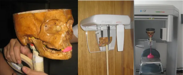 Figura 4. Ubicación de pines metálicos y ubicación del cráneo de la prueba piloto para la  toma de la radiografía cefálica (2D) y la Tomografía de Haz de Cono (CBCT)