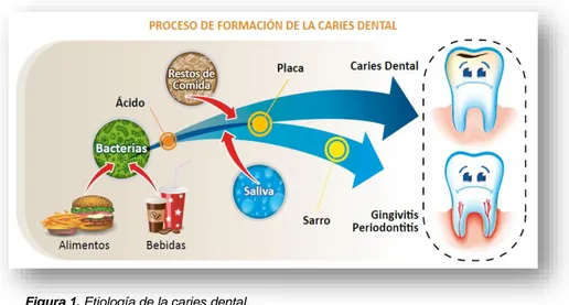 Figura 1. Etiología de la caries dental. 