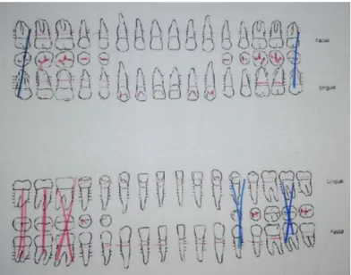 Figura 02. Odontograma 